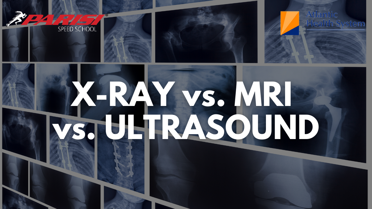 Understanding the Difference: X-Ray , MRI & Ultrasound - Parisi Speed ...